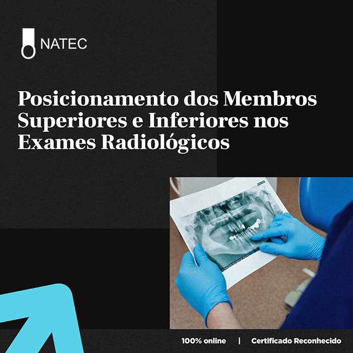 Estudo Electromiográfico Dos Membros Superiores E Inferiores